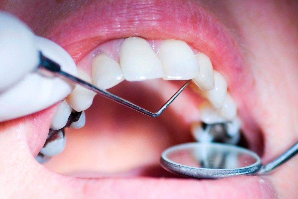 182e4bf61135e410c771acb9b625610e